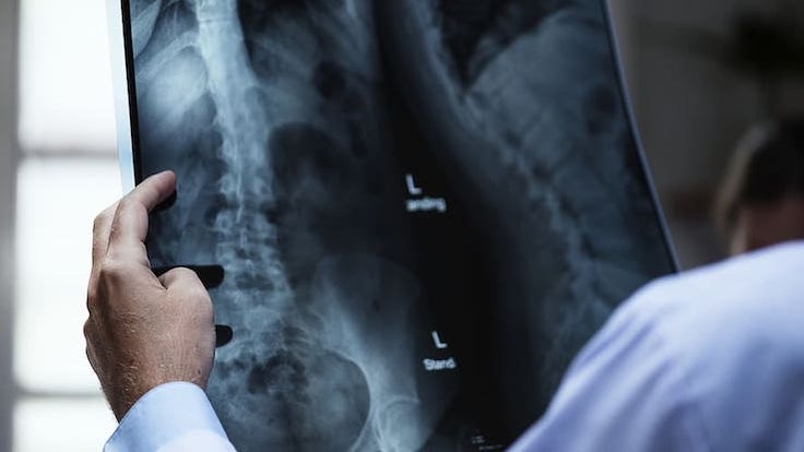 Anatomy Bone Bones Check